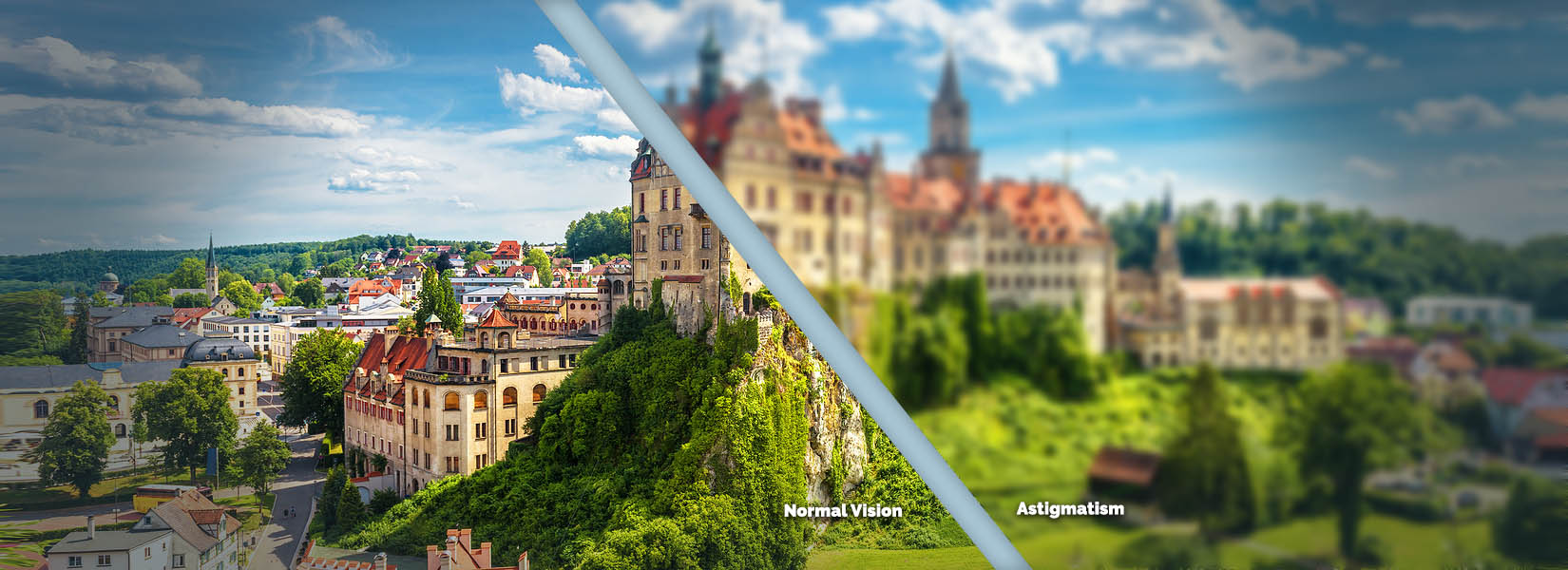 Astigmatism Treatment in Reston
